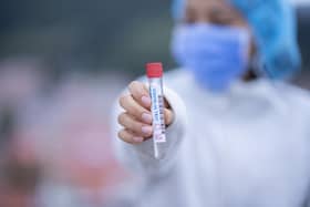 Mass coronavirus testing will soon be available
