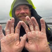 Dave's blistered hands show just how tough the row was