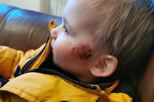 Police are appealing for help to trace the owner of a dog which bit two-year-old Ben Radaviciene in Bulwell on January 24.