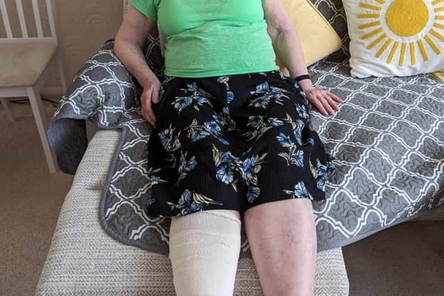 Brenda still needs to see doctors weekly to have her injuries treated. Photo: Submitted