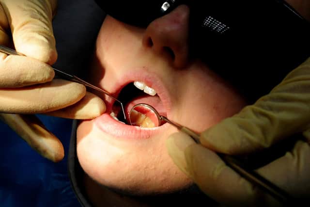 Nationally, 42,200 tooth extractions were conducted on children in hospitals last year