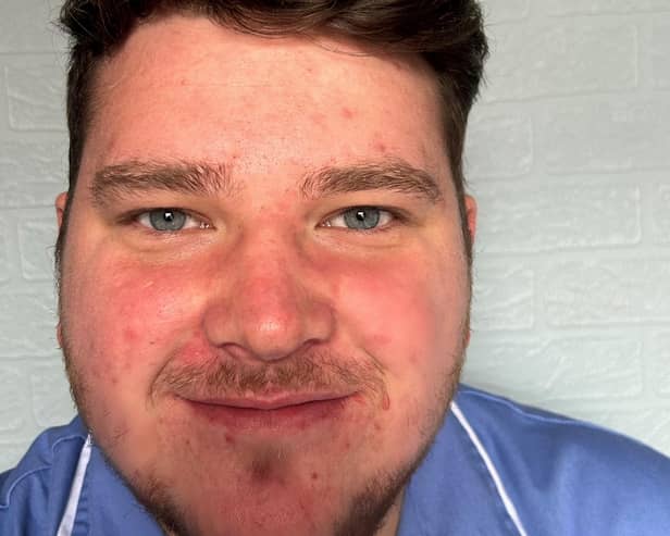 Bulwell man Jack Robinson has completed his five-year nursing apprenticeship