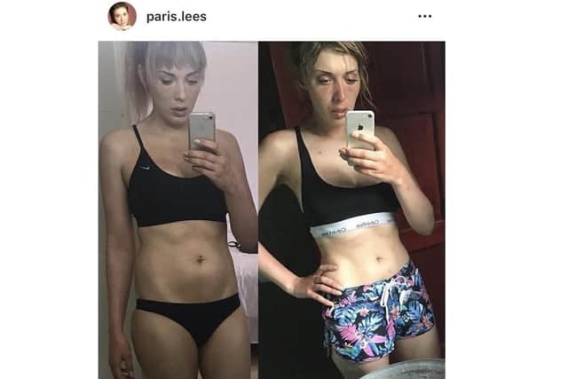She posted about the weight loss online.