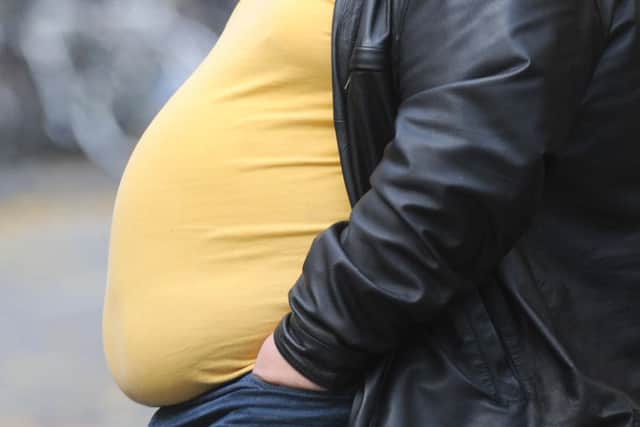 Does shaming people who are overweight help them lose weight?